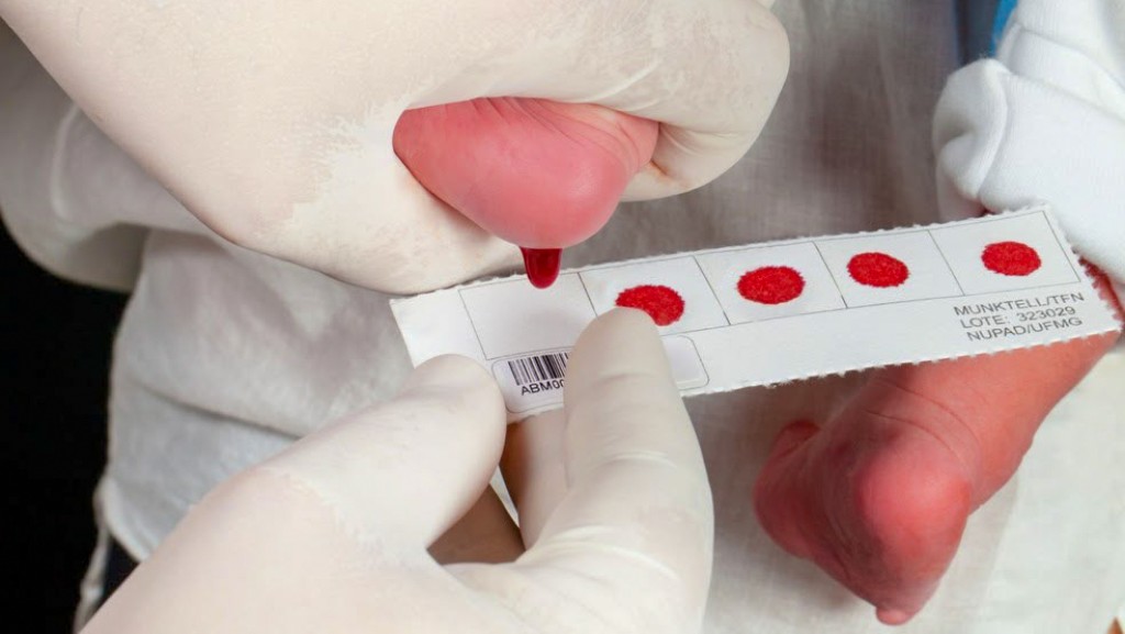 Teste do Pezinho completa 50 anos e reforça importância do diagnóstico precoce em Várzea Grande